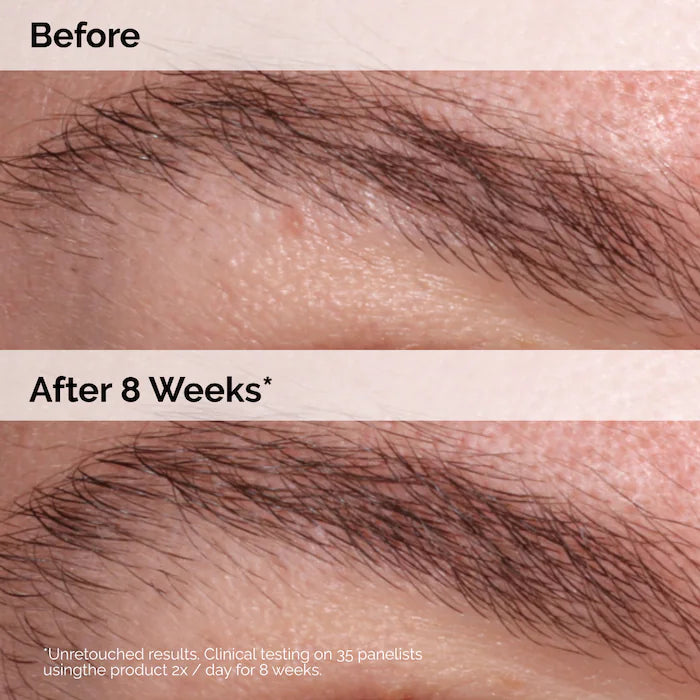 The Ordinary Multi-Peptide Lash and Brow Serum for Thicker, Fuller Looking Lashes & Brows