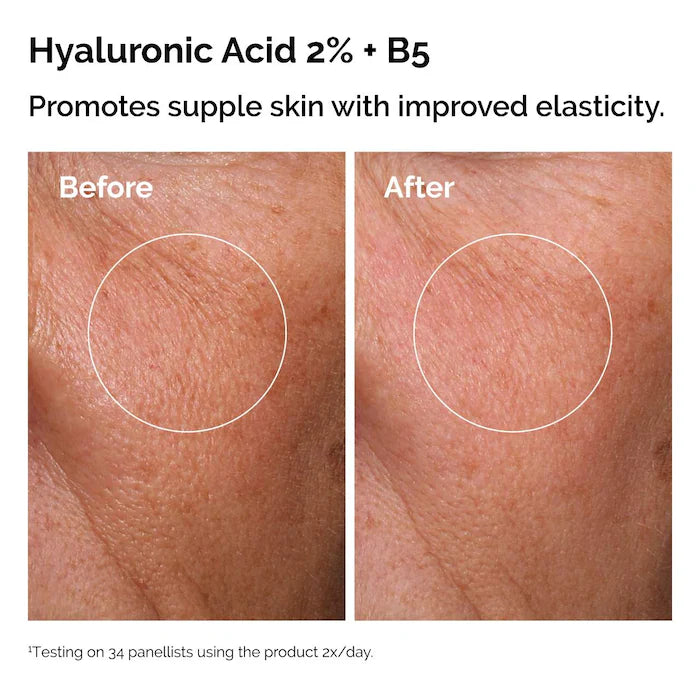 The Ordinary The Skin Support Set with Niacinamide + Hyaluronic Acid